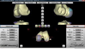 Digitale Simulation perfektioniert Anpassungsverfahren für Teilprothese im Knie | Foto: gespag